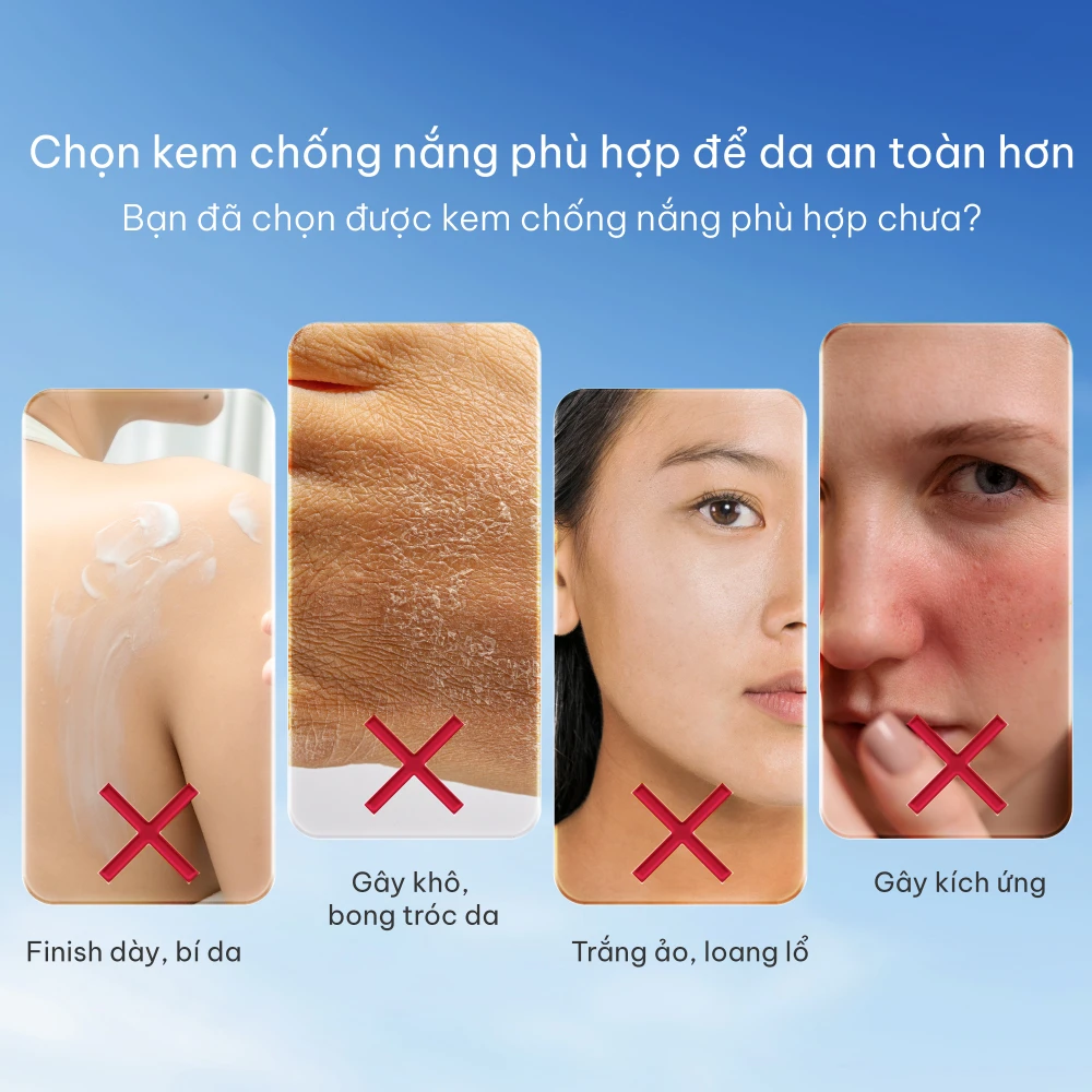 Vitabella – Bí quyết làn da rạng rỡ dưới nắng hè